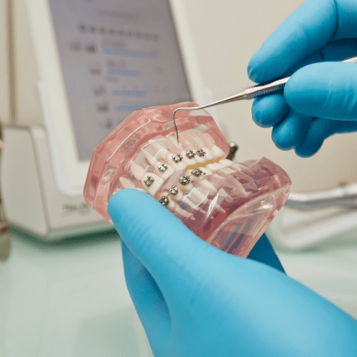 Dentista probando la ortodoncia en Málaga